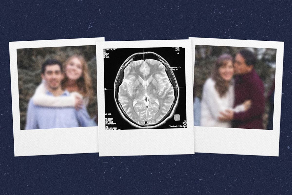 🧠New target for Alzheimer's memory loss