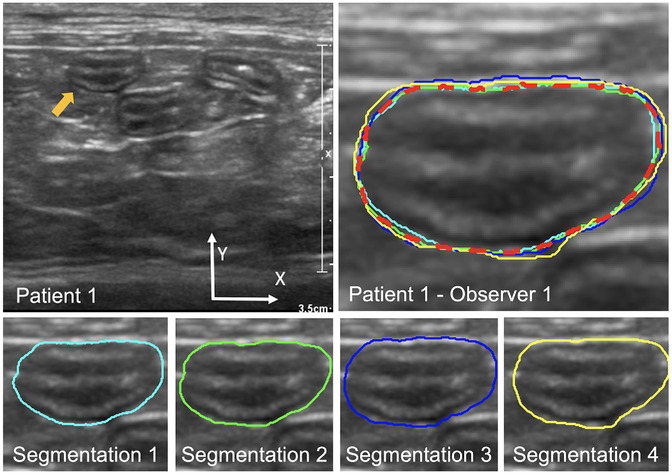 Is AI better than humans at segmenting feline intestines?