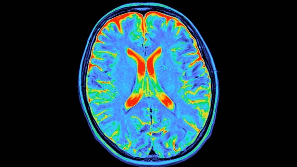 The 4 Brain 'Tipping Points'