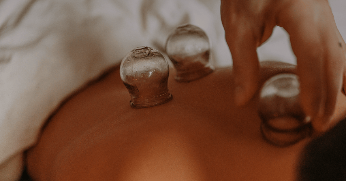 Sliding cupping vs. Light therapy: A new study on plaque psoriasis