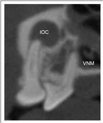 They can be somewhat free floating.....