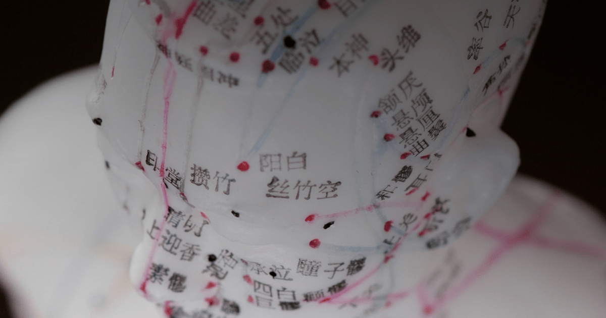 Acupuncture's role in Alzheimer’s disease treatment