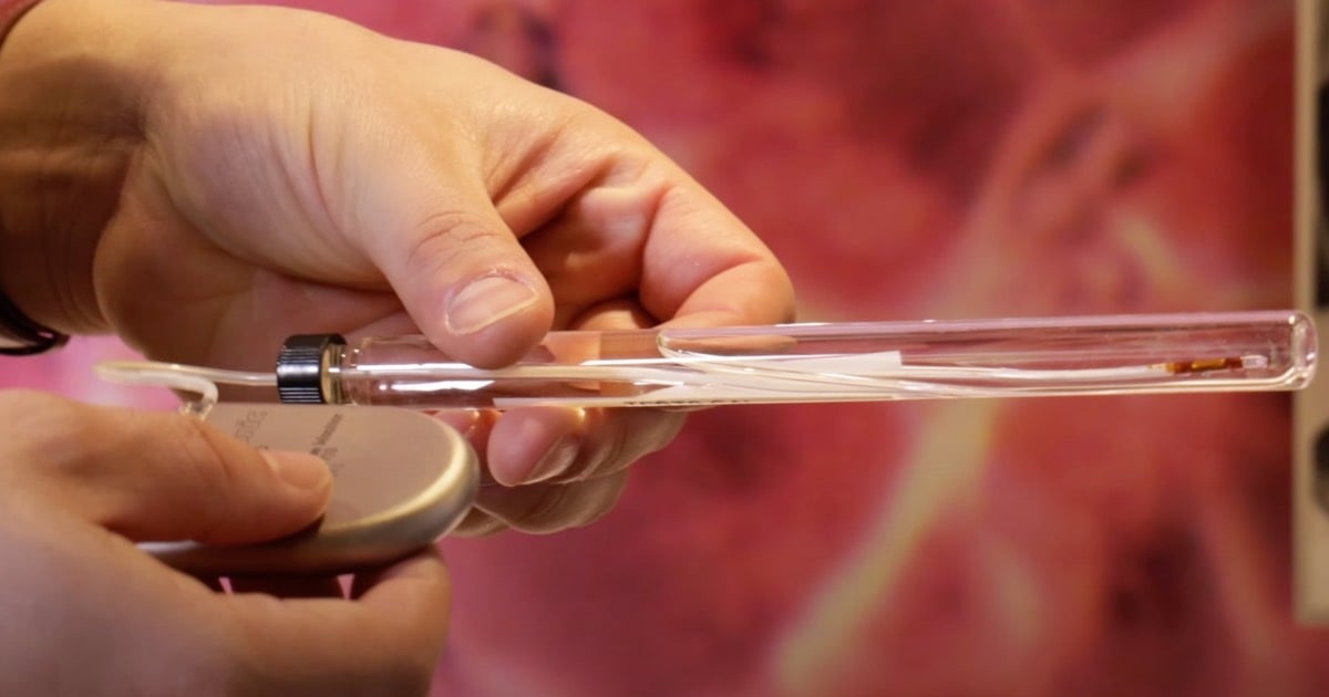 Inside Medtronic’s Implantable Tech - The CGM That Never Launched