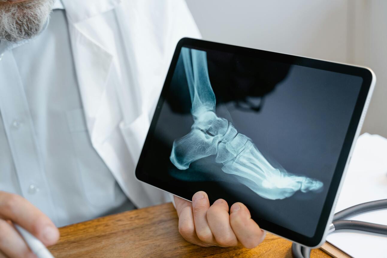Why Your Running Shoes Are Ruining Your Game