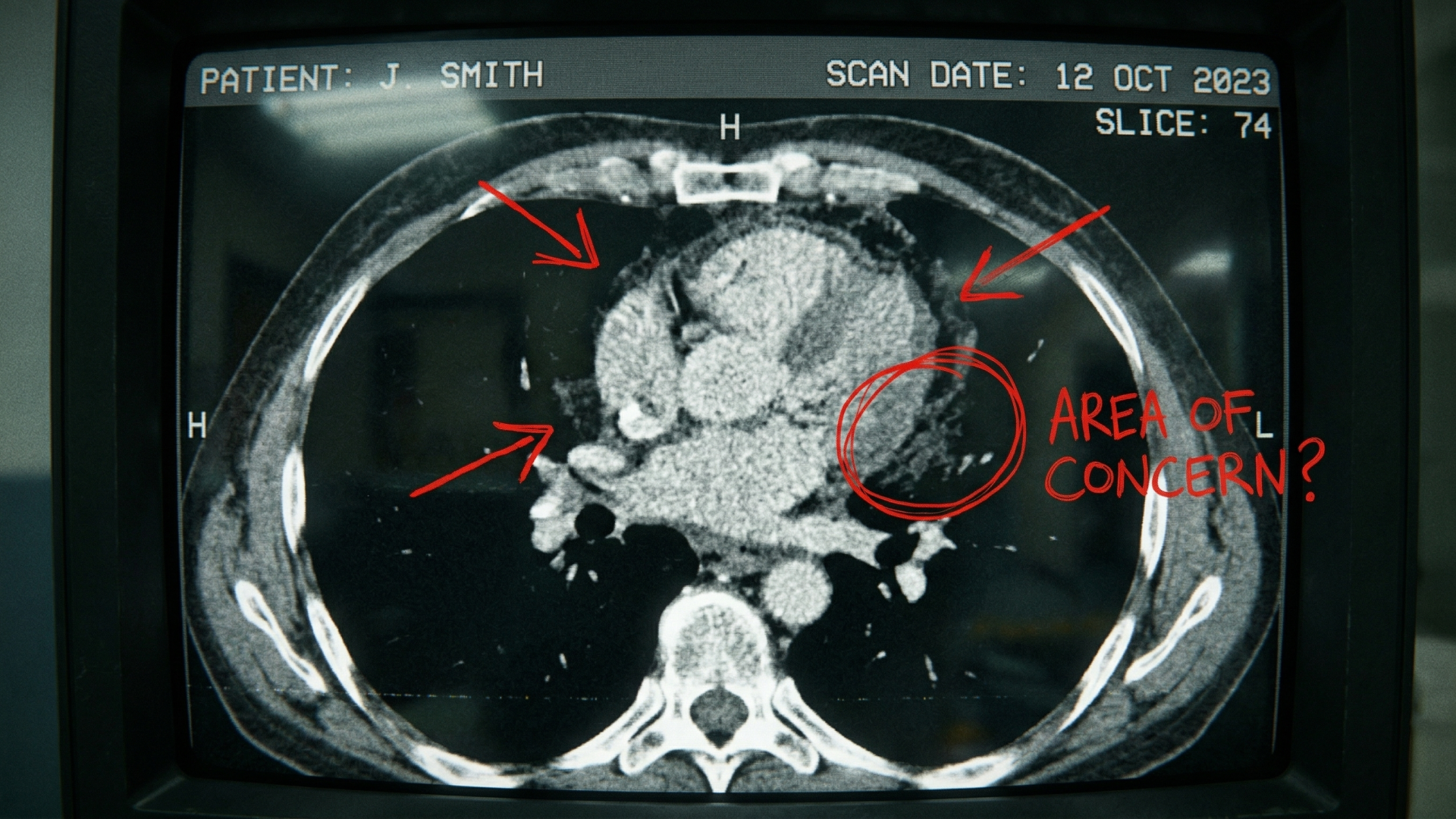 This AI Reads Heart Scans Better Than Any Cardiologist
