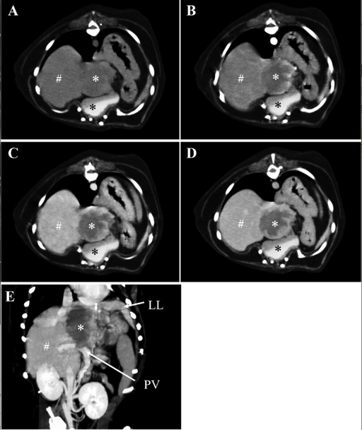Leiomyosarcoma can happen anywhere....