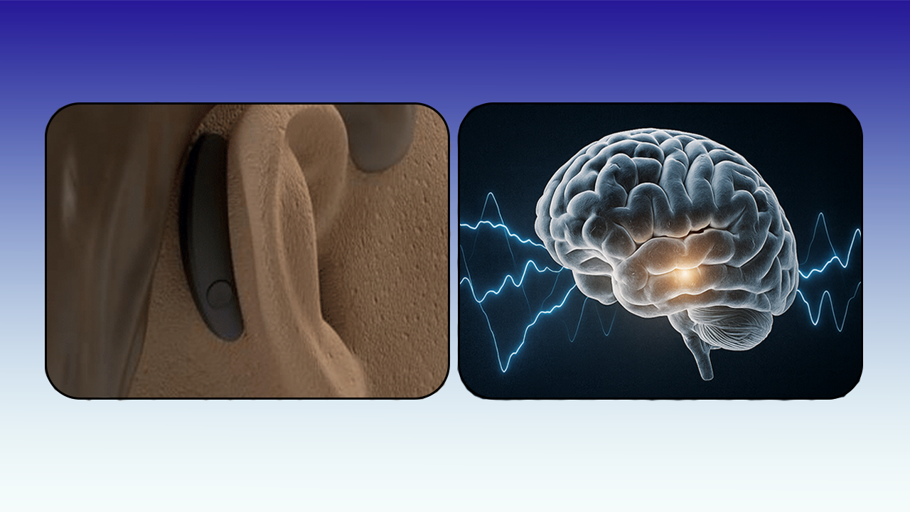 SynchNeuro's CGM Could Measure Glucose Levels Using Brainwaves