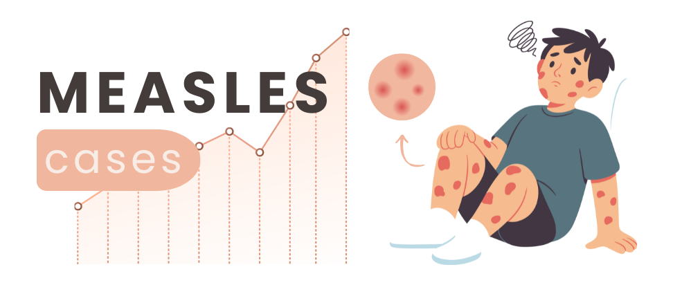 🔢 Measles In Stats | CityClips #569