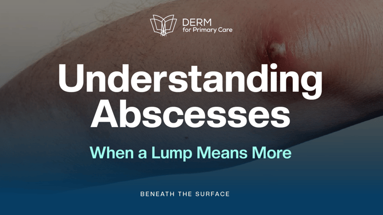 Abscesses: From Identification to Prevention