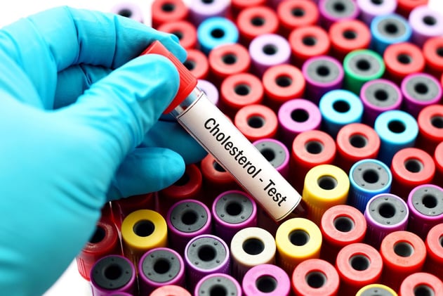 What If We Were Wrong About Cholesterol?