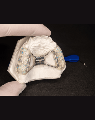 Maxillary expansion and cavities