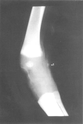 Fetal Horse Rad Study Maps Ossification Timelines to Predict Limb Deformities