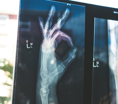 Actithera lands $75.5M to chase next-gen cancer radiopharma