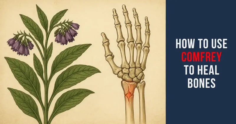 How to Use Comfrey to Heal Bones