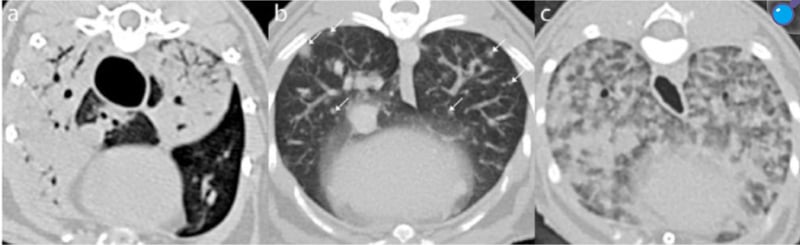 Feline mycobacterium, what are the findings?