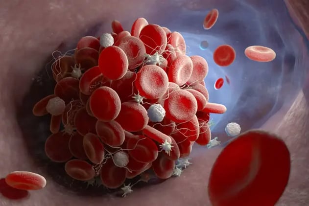 🩸 ¿Tienes las plaquetas bajas? Qué significa y cómo cuidarte si estás en tratamiento oncológico