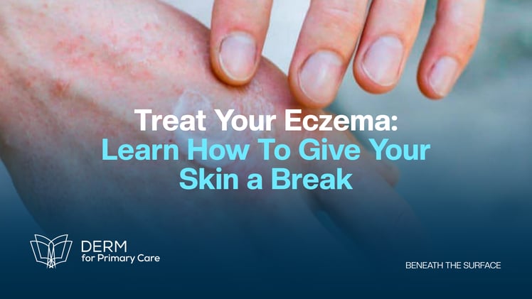 Skin Soothing Secrets for Eczema
