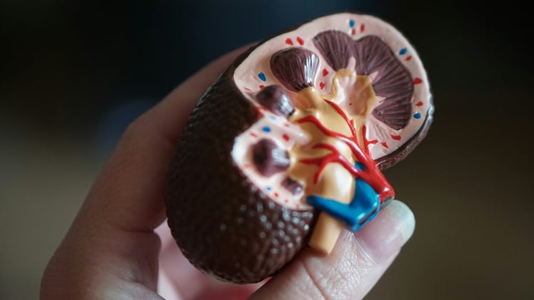 ProKidney’s cell therapy shows promise in chronic kidney disease trial