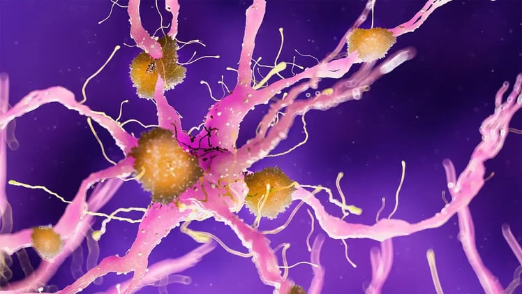 Is Lithium Deficiency Causing Alzheimer’s?