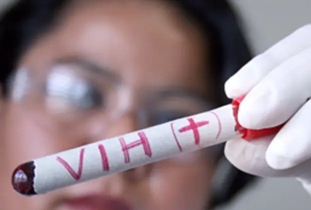HIV positivo: el debate sobre si contárselo o no a tu compañero sexual