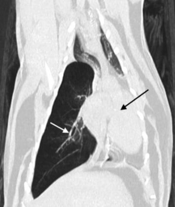 Lung Lobe Blowout: CT Highlights Key Signs of Lobar Emphysema in Dogs and Cats