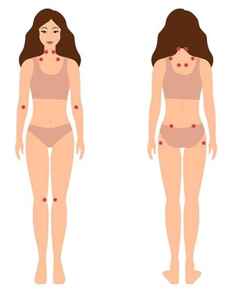 Fibromyalgia Timeline