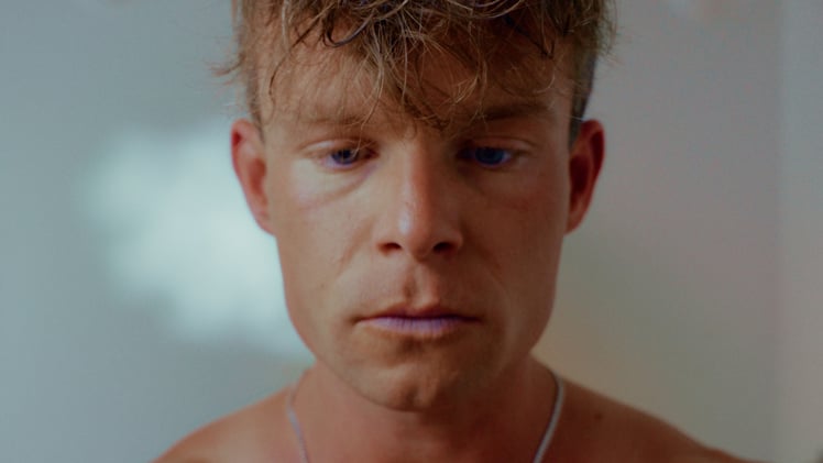 Hair Loss & Ben & Jerrys