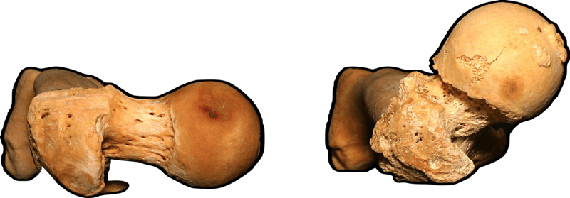 ¿Por Qué las Personas TIENEN Que Hacer Sentadillas de Manera Diferente?