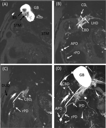 Should we MR our biliary disease dog?