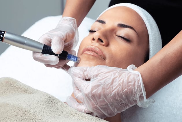 What to Know Before Getting Dermabrasion