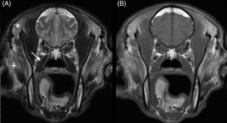 A basset disease or normal variant?