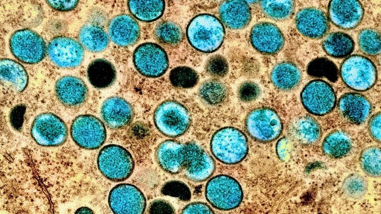 🚨🦠 Mpox Madness & Nusantara No-Go: Global Health Scares and Capital Chaos! 🛑