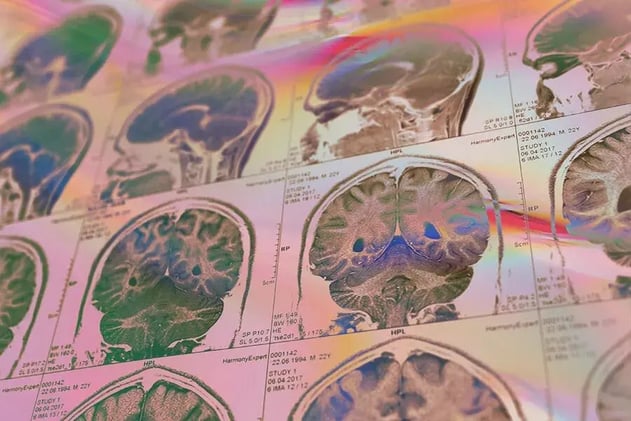 Can Psychedelics Jumpstart Consciousness?