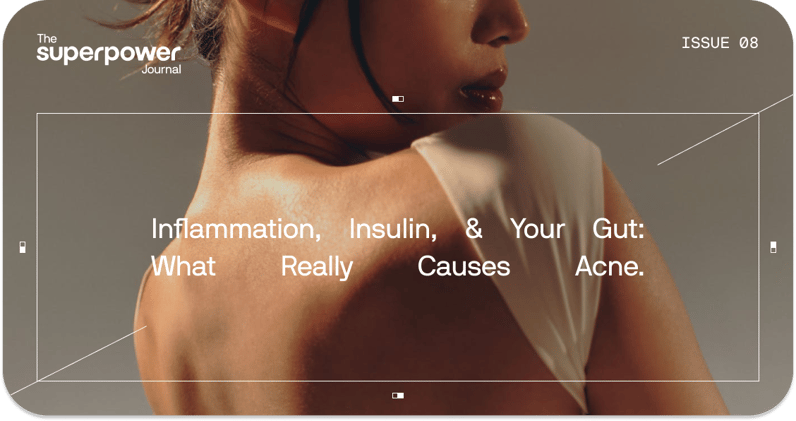 Inflammation, Insulin, & Your Gut: What Really Causes Acne Post