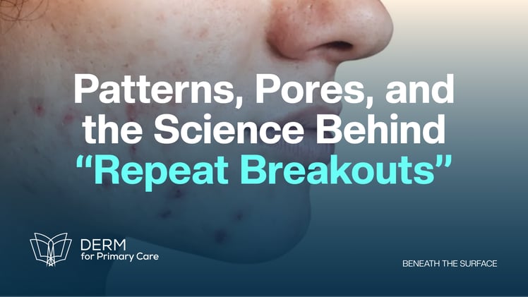 Patterns, Pores, and the Science Behind “Repeat Breakouts”
