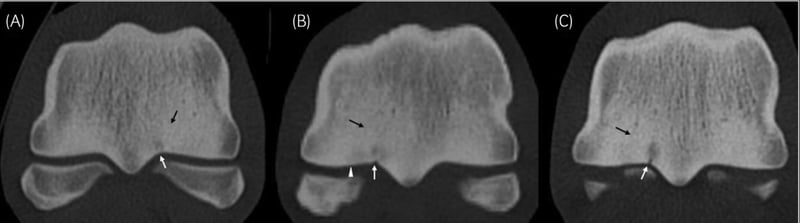 Should we start pre-racing screening?