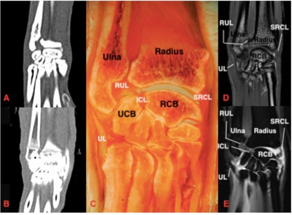How can we see those feline carpal ligaments?
