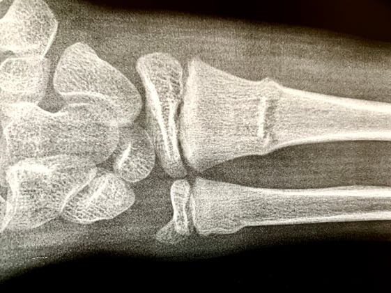 An unexpected lesson from the ER