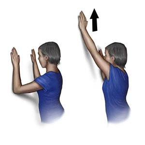 Recuperación del brazo después de una mastectomía: ejercicios, tiempos y señales de alerta
