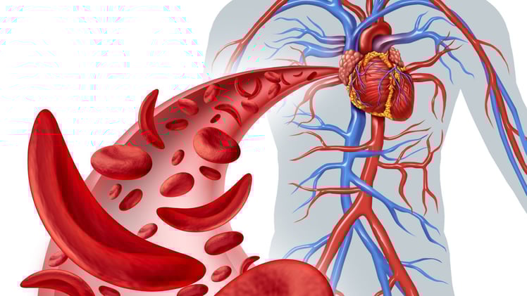 When the Pain Hits: Understanding Sickle Cell Crisis Before It Hits You