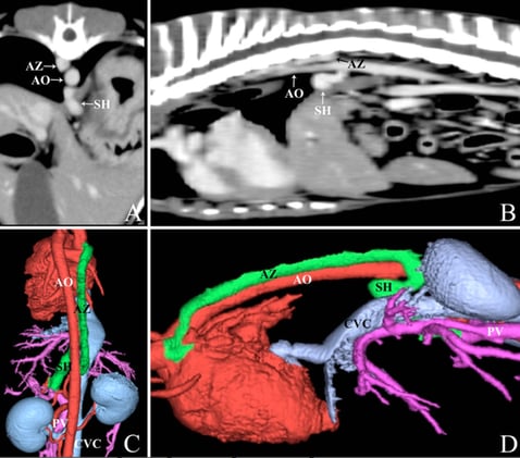 Did you know that all porto-azygous shunt terminate in the thorax and pass through the esophageal hiatus?