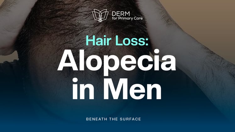 Alopecia in Men: Beyond the Hairline