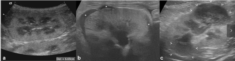 How Do Kidneys Change After Chemotherapy? Ultrasound Insights into Feline Renal Lymphoma
