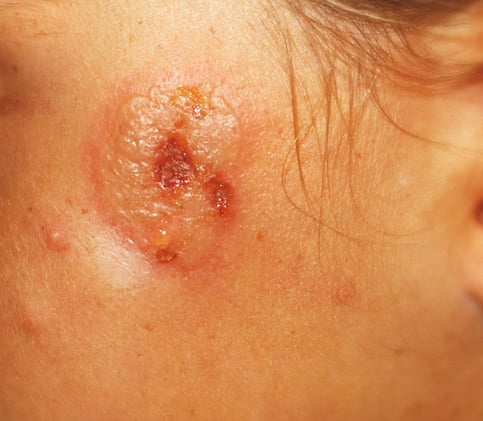 What is the Most Likely Diagnosis? 