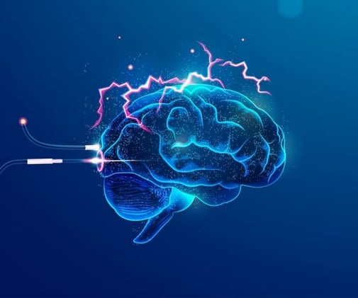 The Hidden Facts About Brain Aneurysms Everyone Should Know