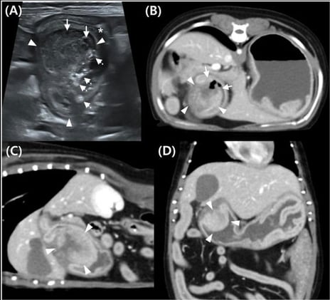 Rare Gastric Tumors in Dogs: Imaging Features of Plasmacytoma Unveiled