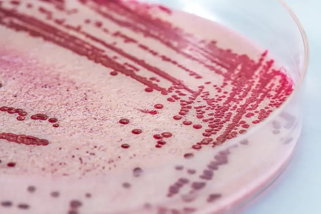 Listeria Outbreak Linked to Recalled Pasta Meals