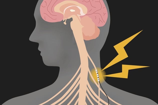 Vagus Nerve: Your Body's Master Reset Button for Anxiety, Inflammation & Disease