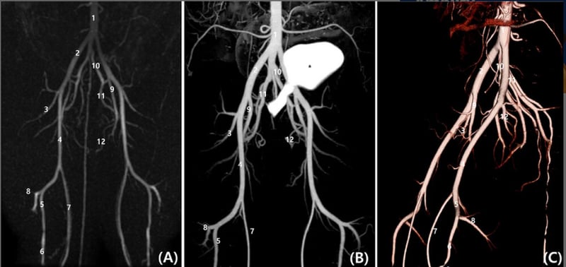 TRICKS Outperforms: Dynamic MRI Offers High-Quality Canine Limb Angiography