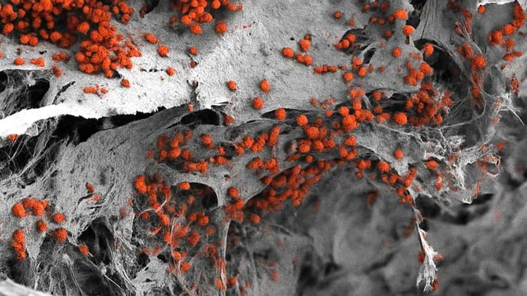 Sunday Special: Scientists grow bone marrow in the lab